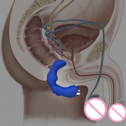Массажеры простаты