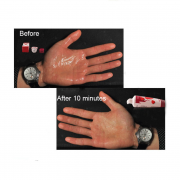 Лубриканты и аксессуары