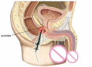 Анальные игрушки