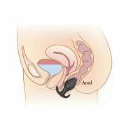 Анальные пробки