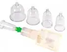 Вакуумная помпа CUPPING SET 5 PCS. TRANSPARENT photo 1