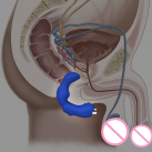 Вибрационный массажер простаты photo 1